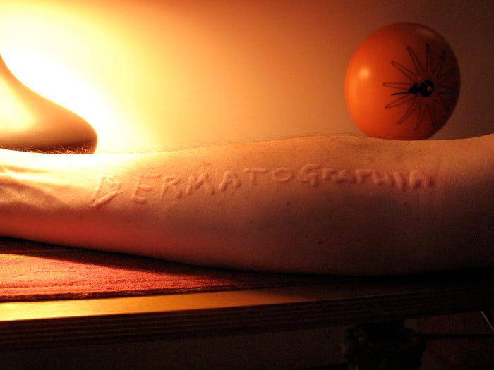 https://commons.wikimedia.org/wiki/File:Dermatographia.JPG
